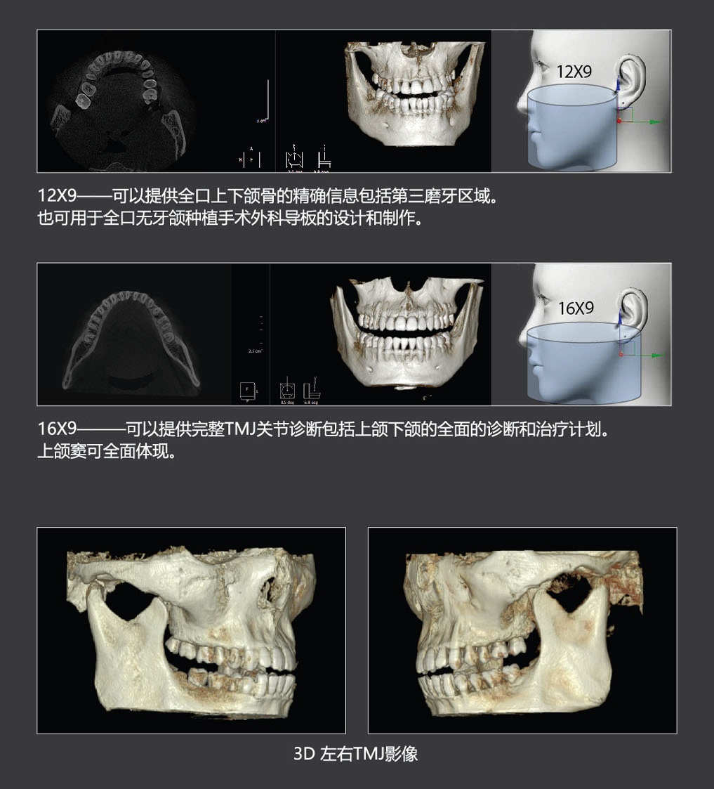 ????? CT (16x9??16x10??) 拷貝